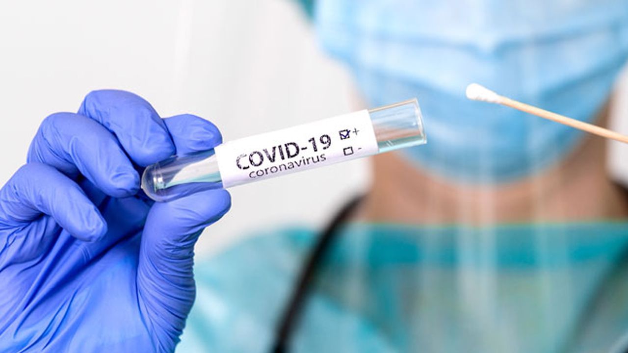 TEST PCR ANTIGENOS CORONAVIRUS 4